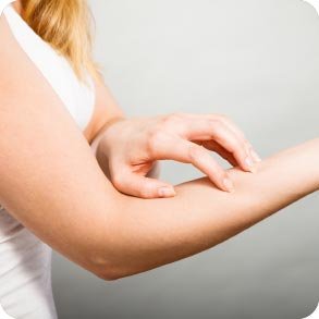 Användning av kräm mot eksem