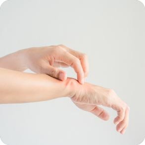 Användning av kräm vid psoriasis